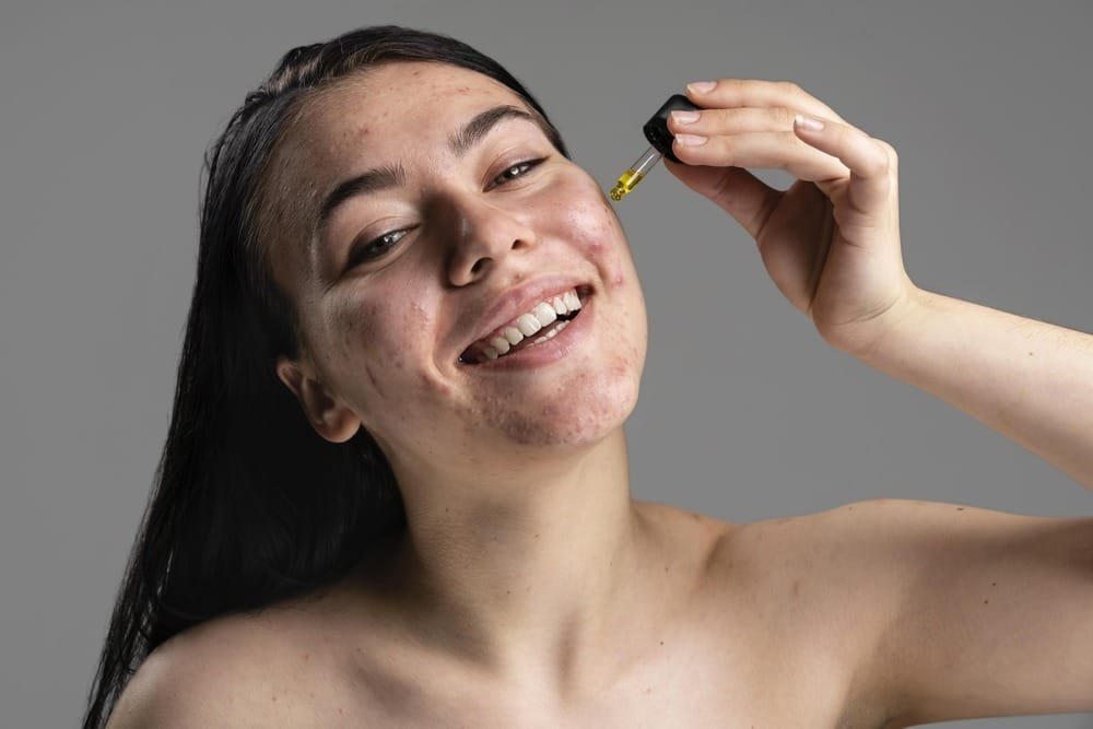 Ayur Raksha - Ayurvedic oil for acne and marks Ayurvedic oil for acne and marks
